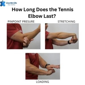 What is Tennis Elbow | how long does the tennis elbow last?