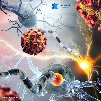 Reasons Why Autoimmune Diseases Are Rising