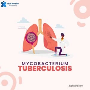 Microscopic view of Mycobacterium tuberculosis bacteria causing tuberculosis infection.